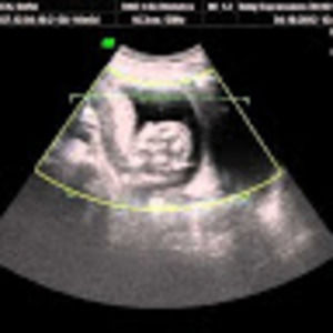 Meet your Posher, Kai